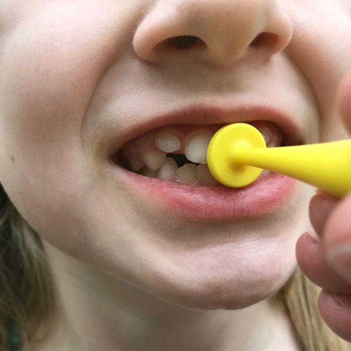 ARK’s proButton™ Set for Lip Closure and Strength Therapy Exercises